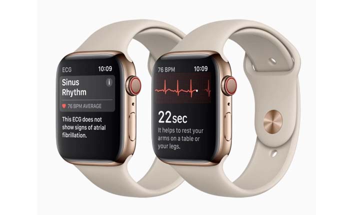 Ini 9 Kelebihan Apple Watch yang Perlu 
